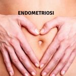 Endometriosi cause e rimedi naturali endometriosi-3 esistere bene