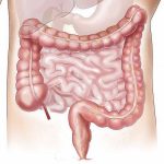 Sindrome dell’intestino irritabile, cause e rimedi naturali Sindrome dell'intestino irritabile rimedi Naturali