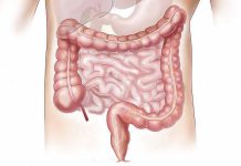 Sindrome dell’intestino irritabile, cause e rimedi naturali Sindrome dell'intestino irritabile rimedi Naturali