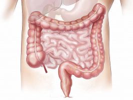 Sindrome dell'intestino irritabile rimedi Naturali