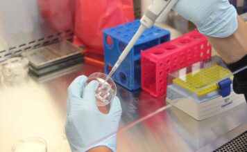 Covid-19, La Lattoferrina è efficace per contrastarlo lattoferrina covid-19